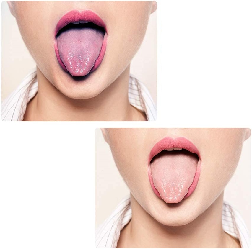 Czyścik Skrobak Szczoteczka Do Czyszczenia Języka Skrobaczka 2 Sztuki