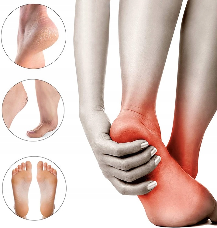 Podpiętki Wkładki Żelowe Do Butów Ostrogi Obtarcia Czarne 2 Sztuki Para