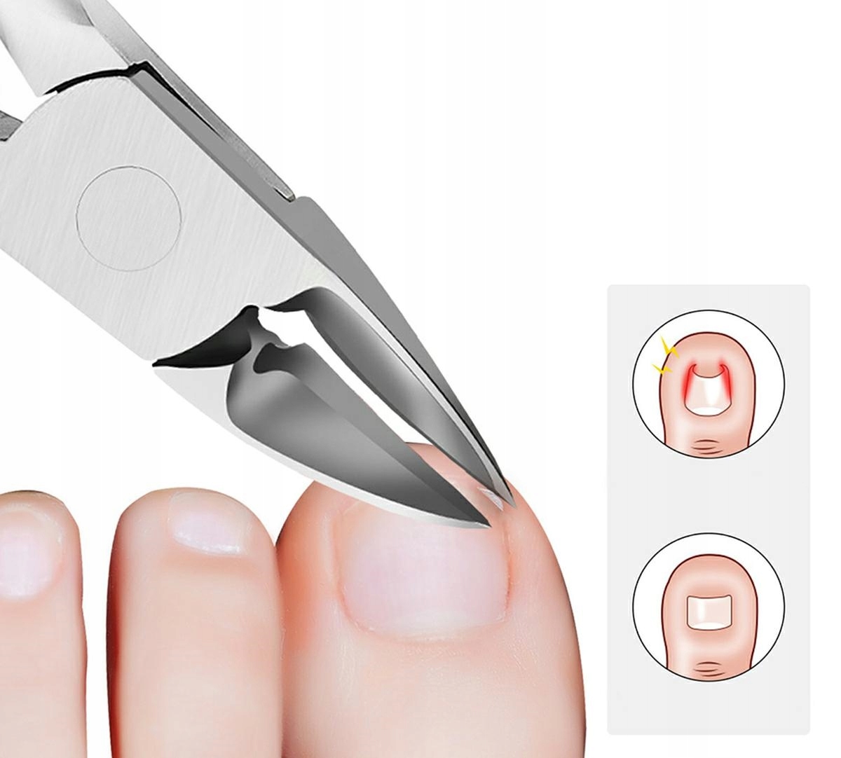 Cążki Do Paznokci Wrastających Grubych Obcinacz Skórek Nożyczki Obcinaczki